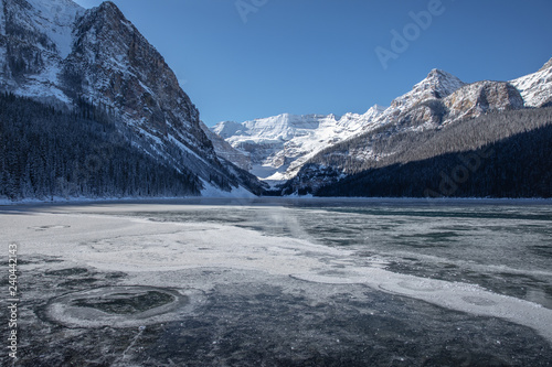Lake Louise Banff Canada During The Winter Season Frozen Glacial