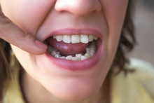 Photo Of Crooked Woman Teeth