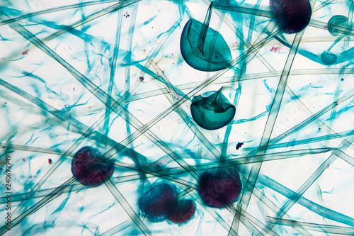 Rhizopus Fungi Viewed Under The Microscope Saprophytic And Parasite Fungi Buy This Stock Photo And Explore Similar Images At Adobe Stock Adobe Stock