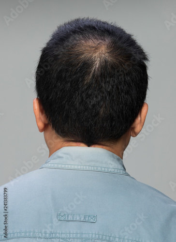 Closeup Macro Portrait Of Male Hair Head Part Human Man Open Thin