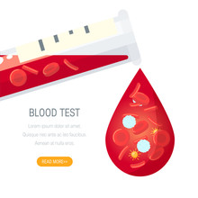 Blood Test Concept, Vector Design In Flat Style