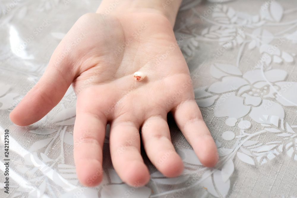 hand holding tooth White kid palm holding first lost milk tooth on neutral background. Little  hand with loose tooth.