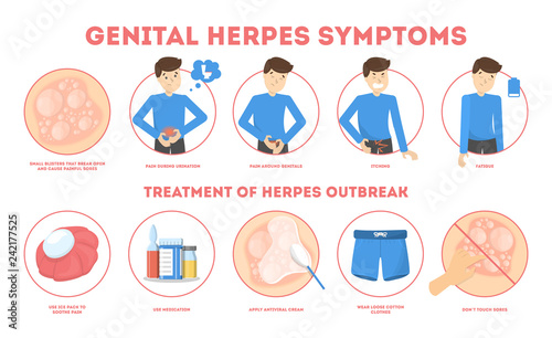 Genital Herpes Symptoms Infectious Dermatology Disease Illustration 