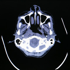 Poster - X-ray scanner of head background.