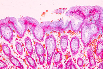  Tissue of Stomach under the microscopic, Physiology of the stomach for education in laboratory.