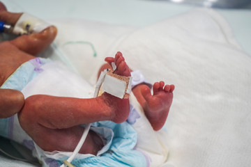 New born baby at the hospital in neonatal care 