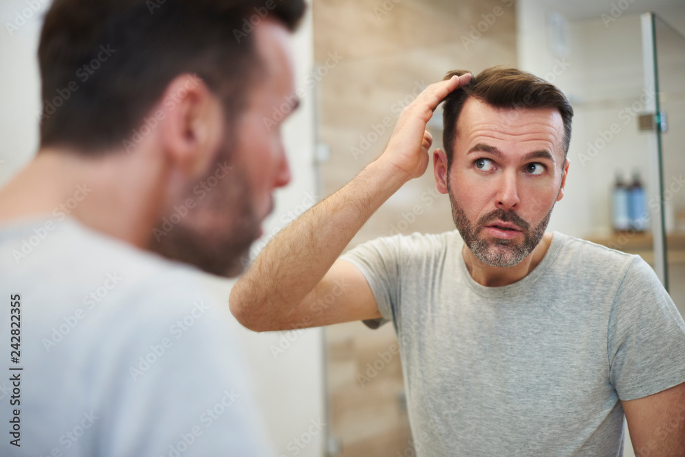 Mature men is worried about hair loss - obrazy, fototapety, plakaty 