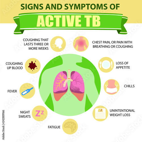 Signs and symptoms of pulmonary tuberculosis. Active TB. Detailed