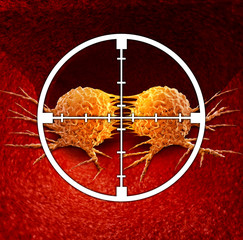 Wall Mural - treating cancer