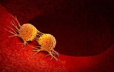 Wall Mural - cancer cell dividing