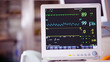 © Mose Schneider - Ventilator monitor vital signs, EKG, ECG, Electrocardiographic selective focus against operating room, emergency room in the hospital, intensive therapy, treatment, critical or care unit, ICU ITU CCU