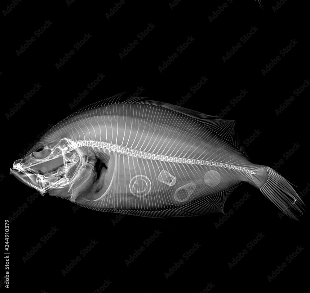 Radiografía en blanco y negro de un pez visto lateralmente con basura ...
