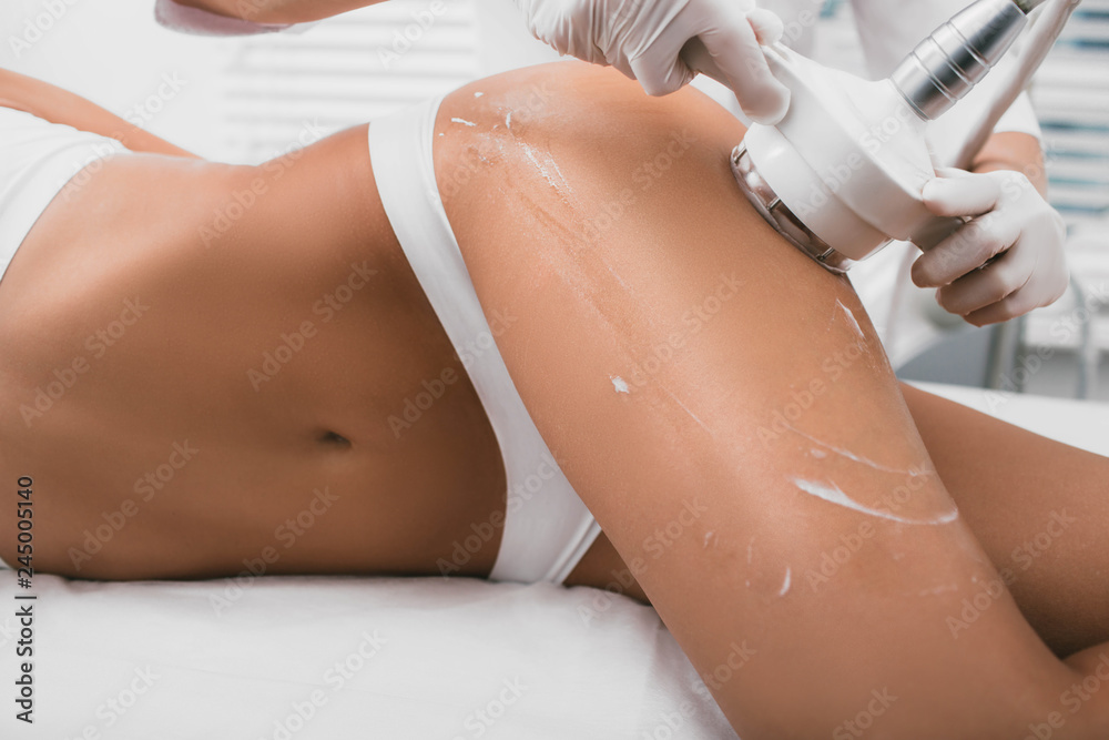 woman having cavitation, procedure removing cellulite on her buttocks , lifting buttocks - obrazy, fototapety, plakaty 