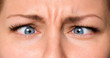 © DenisNata - Pretty Woman eyes suffering from strabismus. Close up of crazy female eyes with squint. Cute girl with mad, comic or surprised face.