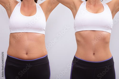 Cuadros en Lienzo Before And After Concept Showing Fat To Slim Woman