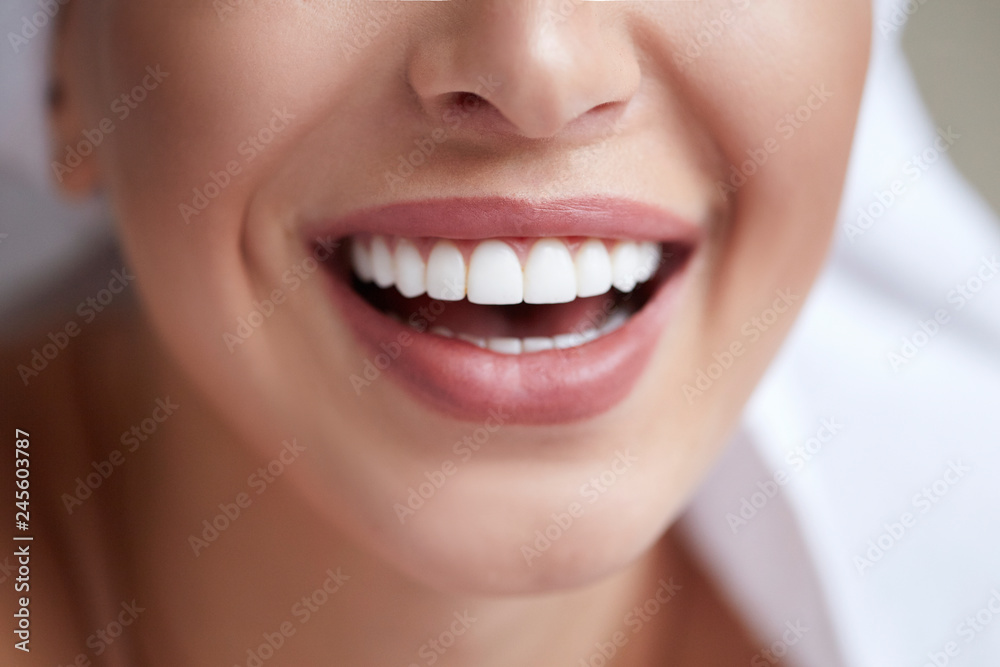 Healthy white smile close up. Beauty woman with perfect smile, lips and teeth. Beautiful Girl with perfect skin. Teeth whitening - obrazy, fototapety, plakaty 
