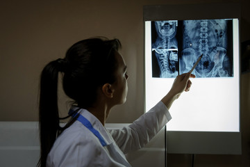 picture of a woman doctor exploring spinal x-ray: lumbar and cervical region - first 2 cervical vertebrae (axis and atlas), the coxofemural joint