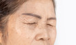 © F16-ISO100 - close up skin wrinkle and freckles of old asian woman face which closing eyes