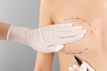 Wall Mural - Doctor drawing marks on patient's breast for cosmetic surgery operation against gray background, closeup