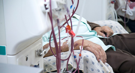 hemodialysis in people on the equipment