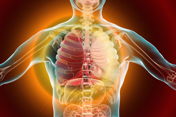 Wall Mural - Pneumonia medical concept, 3D illustration showing lobar pneumonia of the right lung in the phase of grey hepatization