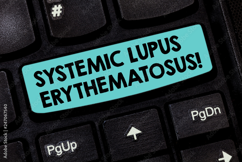 Pc Form Sle Text sign showing Systemic Lupus Erythematosus. Conceptual photo immune ...