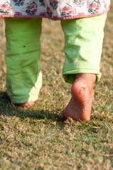 A girl is walking on the wet grass