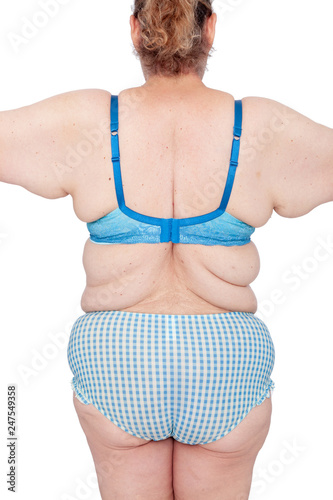 Middle Aged Woman With Sagging Excess Arm Skin After Extreme Weight Loss Before Brachioplasty Panniculectomy Abdominoplasty And Mummy Makeover Back View Arms Out With Bingo Wings Buy This Stock Photo And