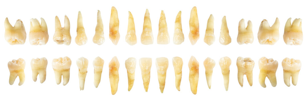Fototapete - Tooth diagram ( photography ). Real teeth chart . front horizontal view . isolated white background