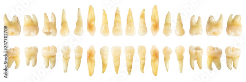 Fotografía Tooth diagram ( photography )