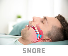 Illustration Showing Airway During Snore