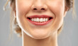 oral care, dental hygiene and people concept - close up of smiling woman face with white teeth over gray background