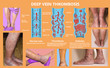 Economy class syndrome mechanism, deep vein thrombosis or DVT, Pulmonary Embolism, coronary thrombosis, diagram