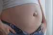 Umbilical hernia in a pregnant woman. Closeup