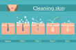 Facial skin care, pore cleaning. Cleansing stages on clogged face. Skin cleaning steps. Vector illustration.