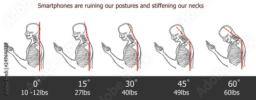 Fotomural The bad smartphone postures,the angle of bending head related to the pressure on the spine, vector flat cartoon illustration