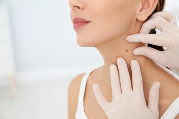 Wall Mural - Dermatologist examining patient's birthmark in clinic, closeup. Space for text