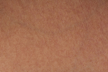 Flat skin pattern