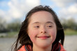 © denys_kuvaiev - Portrait of down syndrome girl smiling