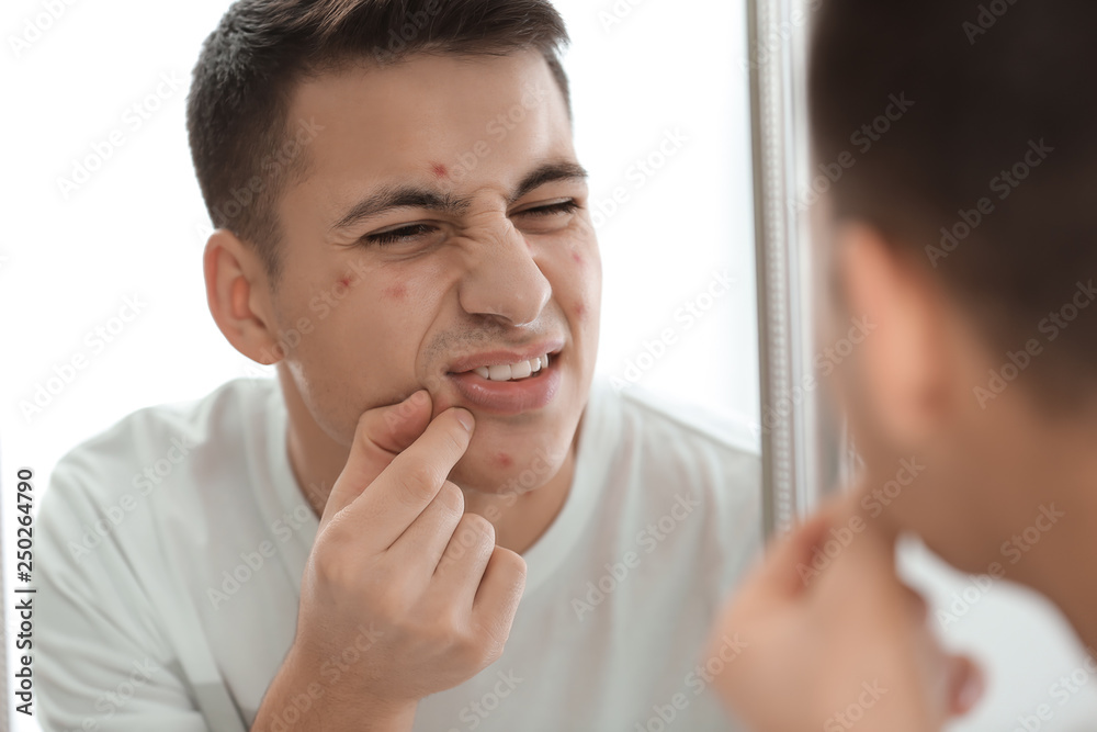 Portrait of young man with acne problem looking in mirror at home