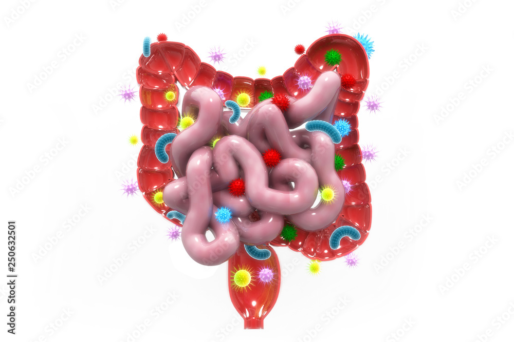 Virus and bacteria infected the human colon. colon disease concept. 3d illustration