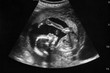 © strelov - Ultrasound with pregnancy Obstetric of fetus Medical images. pregnant mother.