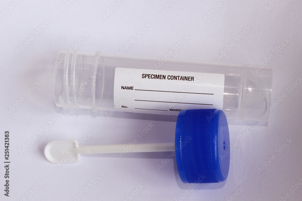 Fecal Sample Test for Disease Assessment and Diagnosis Stock Photo ...