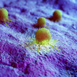 3d rendered illustration of human cancer cells