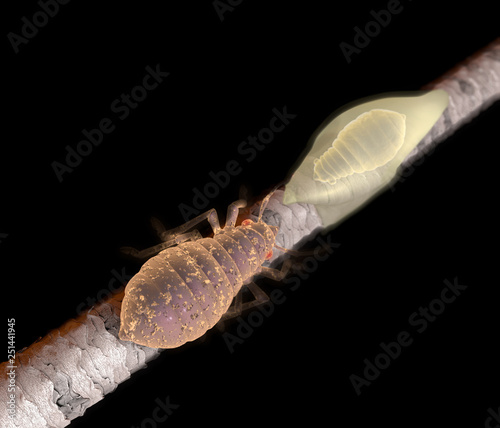 Lice On Hair Close Up As A Medical Problem Concept As Follicles