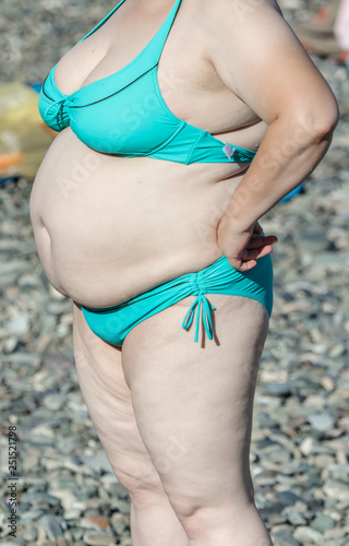 Fat chick in bikini