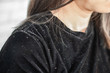 closeup woman hair with dandruff falling on shoulders