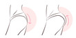 © Lin - beauty woman with butt implant