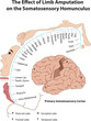 Primary Somatosensory Cortex. The Effect of Limb Amputation  on the Somatosensory Homunculus