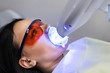 Laser bleaching teeth at dantist room. Teeth whitening for woman. Bleaching of the teeth at dentist clinic. Dental care.